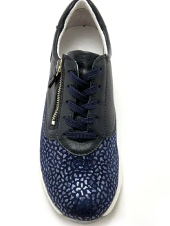 Baskets extensibles idéal hallux valgus